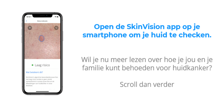 CZ en SkinVision | Kosteloos voor CZ verzekerden